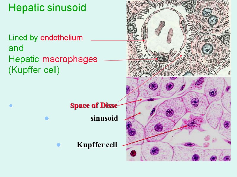 Hepatic sinusoid   Lined by endothelium and Hepatic macrophages (Kupffer cell)  